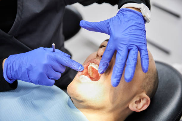 Best Urgent Care for Lost Fillings or Crowns in Clymer, PA